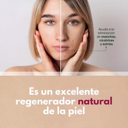 Aceite esencial UNIFLORA® Rosa Mosqueta CJA/BOT. 010ml